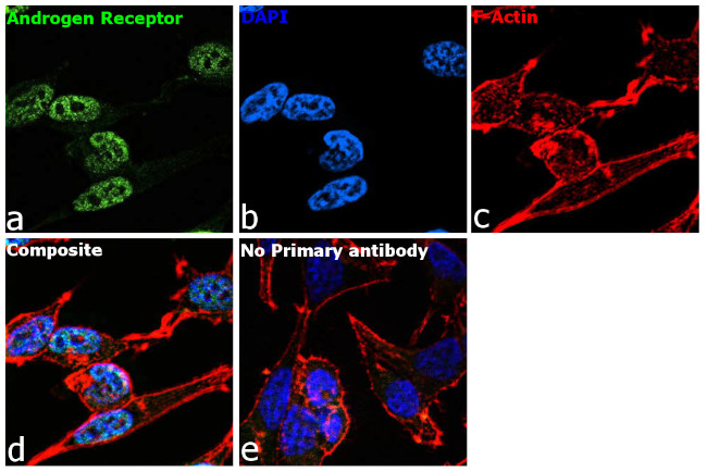 Androgen Receptor Antibody in Immunocytochemistry (ICC/IF)