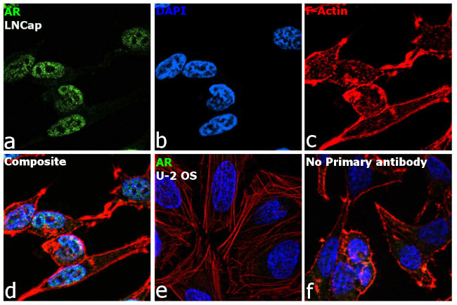 Androgen Receptor Antibody