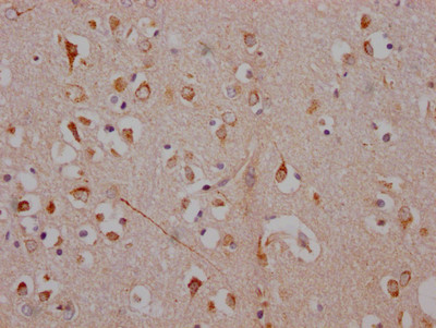 ADORA1 Antibody in Immunohistochemistry (Paraffin) (IHC (P))