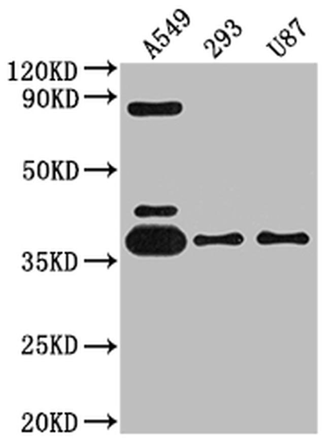 ADORA1 Antibody in Western Blot (WB)