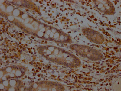 MEK1 Antibody in Immunohistochemistry (Paraffin) (IHC (P))