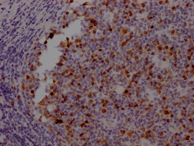 Aurora B Antibody in Immunohistochemistry (Paraffin) (IHC (P))