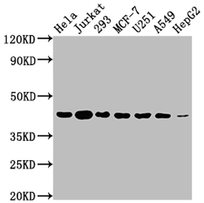 Aurora B Antibody in Western Blot (WB)