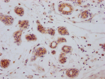 Bcl-xL Antibody in Immunohistochemistry (Paraffin) (IHC (P))