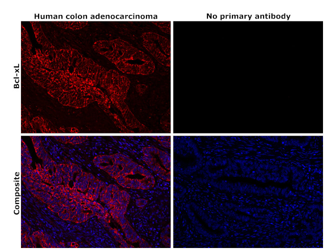 Bcl-xL Antibody in Immunohistochemistry (Paraffin) (IHC (P))