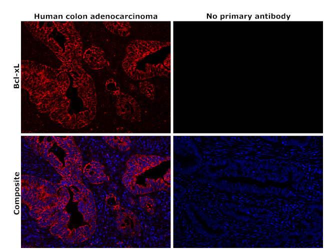 Bcl-xL Antibody in Immunohistochemistry (Paraffin) (IHC (P))