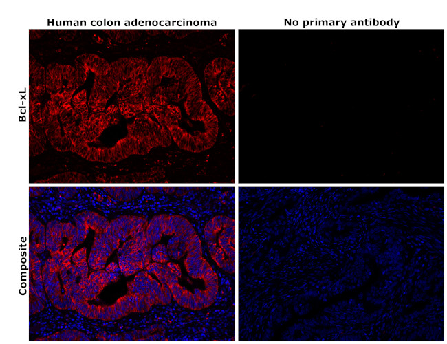 Bcl-xL Antibody in Immunohistochemistry (Paraffin) (IHC (P))