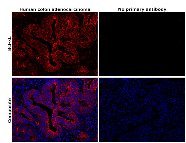 Bcl-xL Antibody in Immunohistochemistry (Paraffin) (IHC (P))