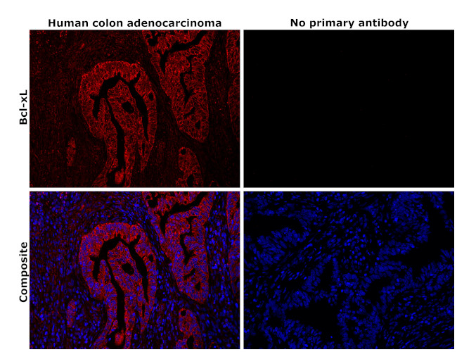 Bcl-xL Antibody in Immunohistochemistry (Paraffin) (IHC (P))