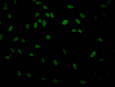 IKK beta Antibody in Immunocytochemistry (ICC/IF)