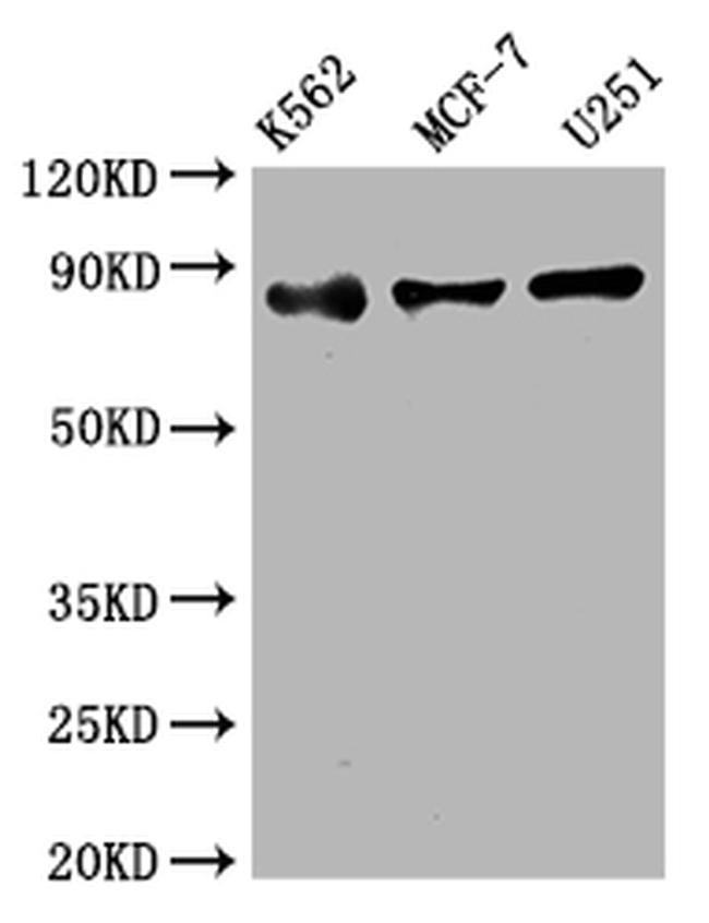 IKK beta Antibody in Western Blot (WB)