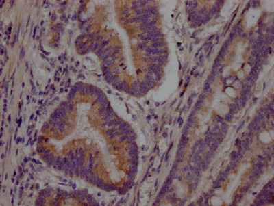 PCSK9 Antibody in Immunohistochemistry (Paraffin) (IHC (P))