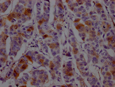 DHFR Antibody in Immunohistochemistry (Paraffin) (IHC (P))