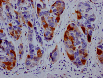 DHFR Antibody in Immunohistochemistry (Paraffin) (IHC (P))