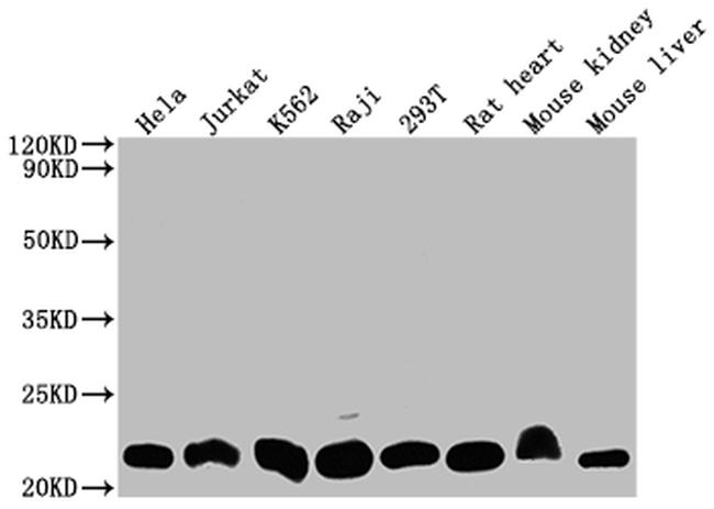 DHFR Antibody in Western Blot (WB)