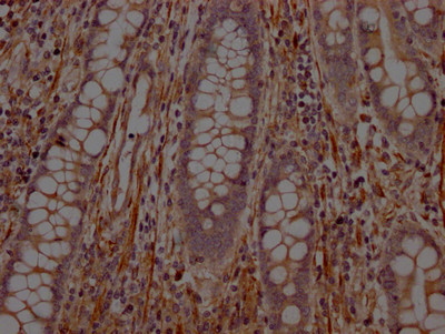 PTP1B Antibody in Immunohistochemistry (Paraffin) (IHC (P))