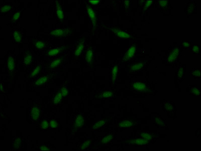 PAK1 Antibody in Immunocytochemistry (ICC/IF)