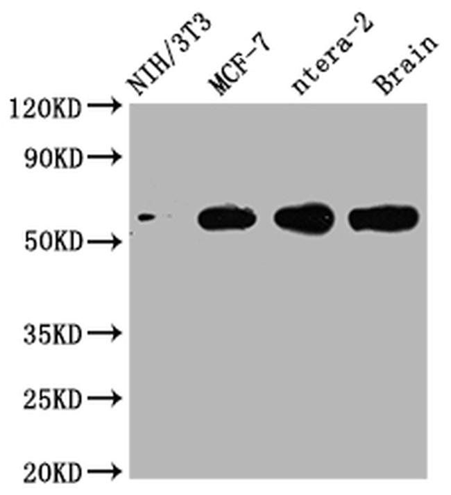 PAK1 Antibody in Western Blot (WB)