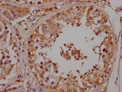 NGF Antibody in Immunohistochemistry (Paraffin) (IHC (P))