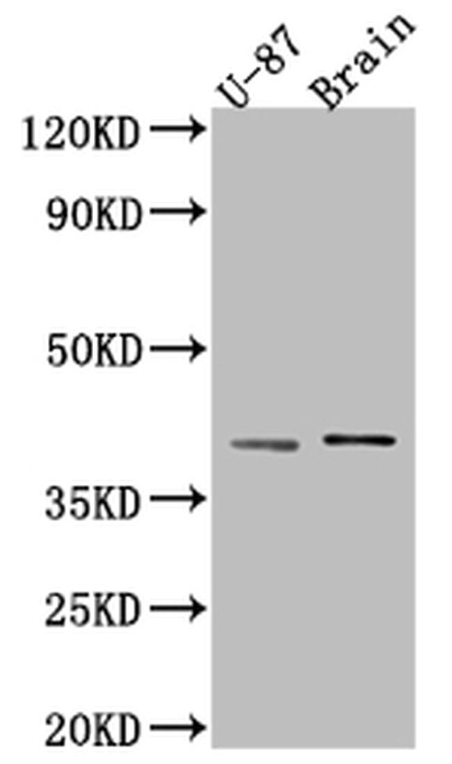 NGF Antibody in Western Blot (WB)