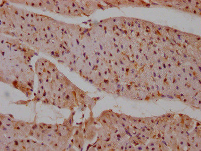 SHP2 Antibody in Immunohistochemistry (Paraffin) (IHC (P))