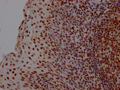 HMGB1 Antibody in Immunohistochemistry (Paraffin) (IHC (P))