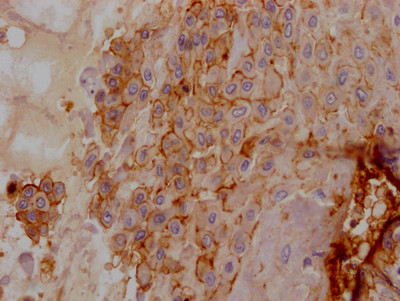 CD55 Antibody in Immunohistochemistry (Paraffin) (IHC (P))