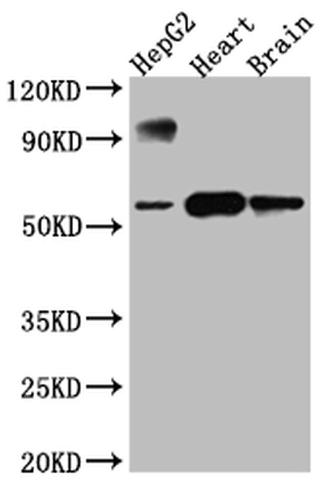 CYP17A1 Antibody in Western Blot (WB)