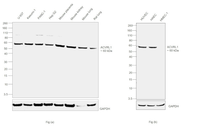 ACVRL1 Antibody in Western Blot (WB)