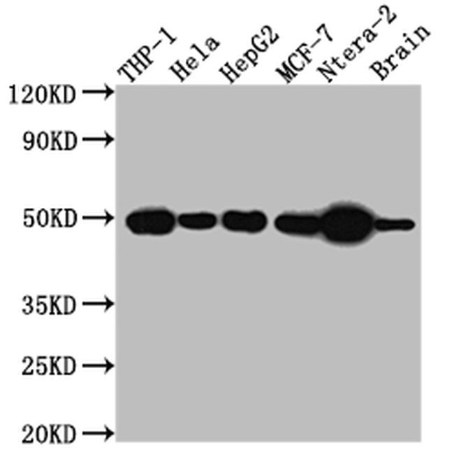 TACR1 Antibody in Western Blot (WB)
