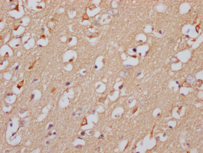 GABRA5 Antibody in Immunohistochemistry (Paraffin) (IHC (P))