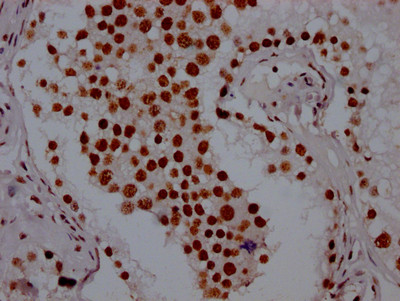 PABPN1 Antibody in Immunohistochemistry (Paraffin) (IHC (P))