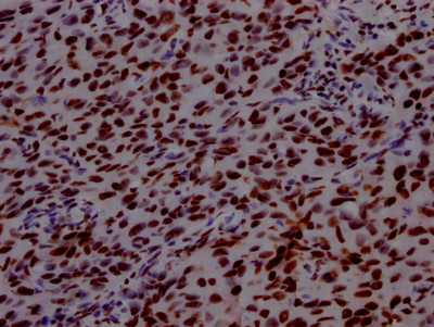 PABPN1 Antibody in Immunohistochemistry (Paraffin) (IHC (P))