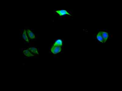 PIK3CA Antibody in Immunocytochemistry (ICC/IF)