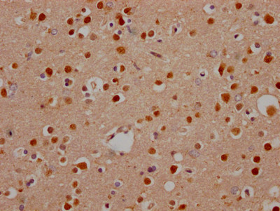 NOTCH1 Antibody in Immunohistochemistry (Paraffin) (IHC (P))