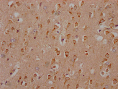 HTR2C Antibody in Immunohistochemistry (Paraffin) (IHC (P))