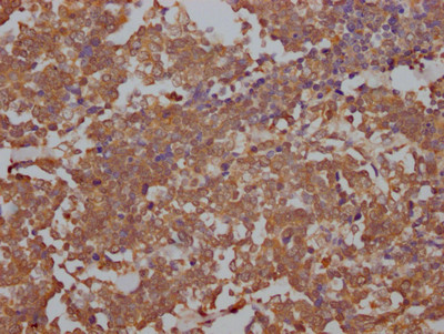 TOP2A Antibody in Immunohistochemistry (Paraffin) (IHC (P))