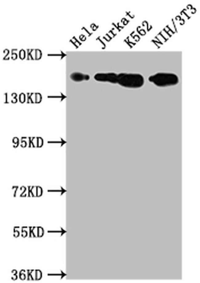 TOP2A Antibody in Western Blot (WB)