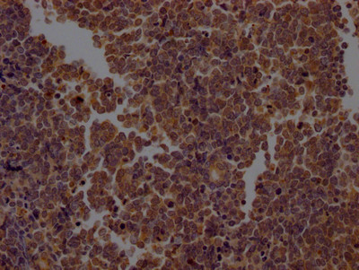 Caspase 2 Antibody in Immunohistochemistry (Paraffin) (IHC (P))