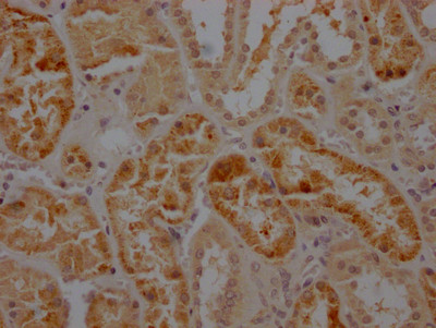 Caspase 2 Antibody in Immunohistochemistry (Paraffin) (IHC (P))