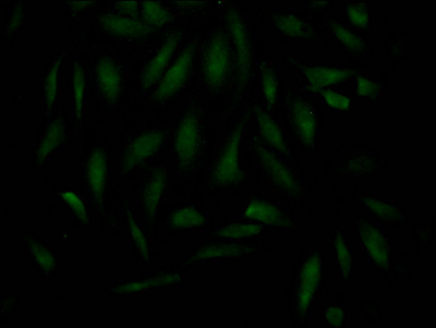 MAD2L2 Antibody in Immunocytochemistry (ICC/IF)