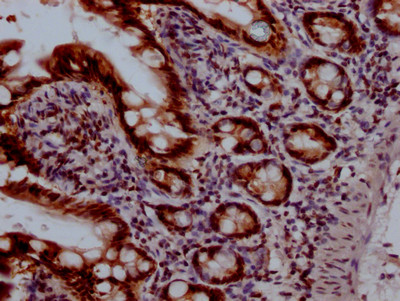 TOP1 Antibody in Immunohistochemistry (Paraffin) (IHC (P))