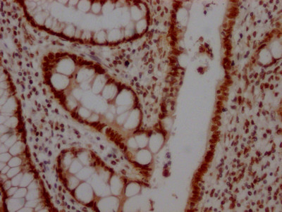 TOP1 Antibody in Immunohistochemistry (Paraffin) (IHC (P))