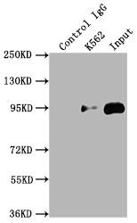 TOP1 Antibody in Immunoprecipitation (IP)