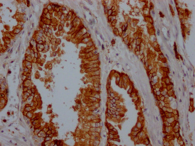 CD38 Antibody in Immunohistochemistry (Paraffin) (IHC (P))