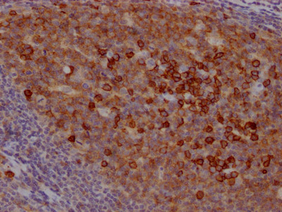 CD38 Antibody in Immunohistochemistry (Paraffin) (IHC (P))