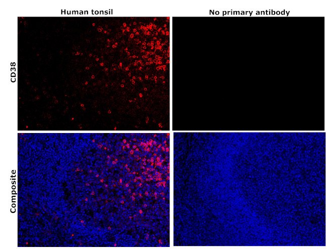 CD38 Antibody in Immunohistochemistry (Paraffin) (IHC (P))