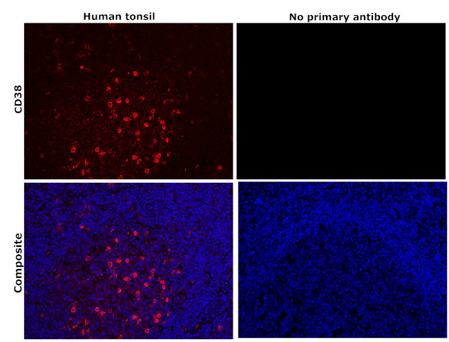 CD38 Antibody in Immunohistochemistry (Paraffin) (IHC (P))