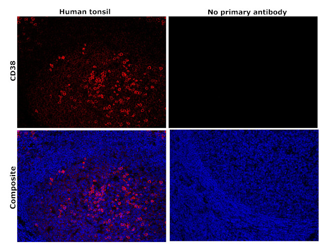 CD38 Antibody in Immunohistochemistry (Paraffin) (IHC (P))