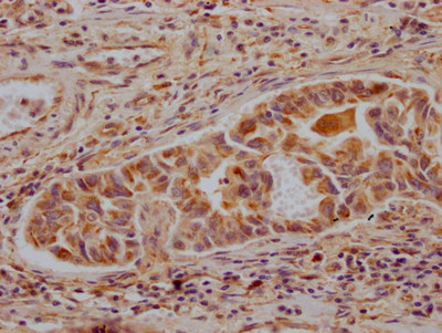 ALDH2 Antibody in Immunohistochemistry (Paraffin) (IHC (P))